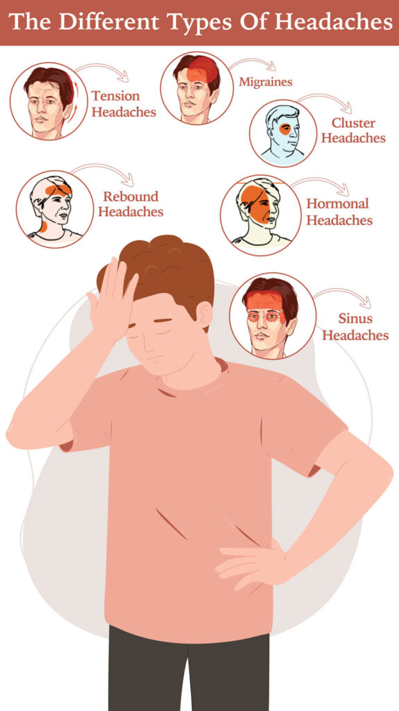 Understanding The Different Types Of Headaches Infographics 575x1024 